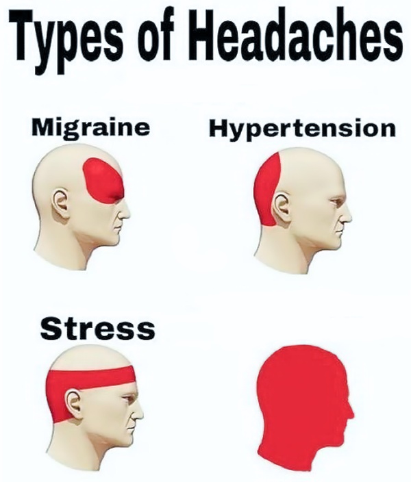 Types of Headaches blank meme template